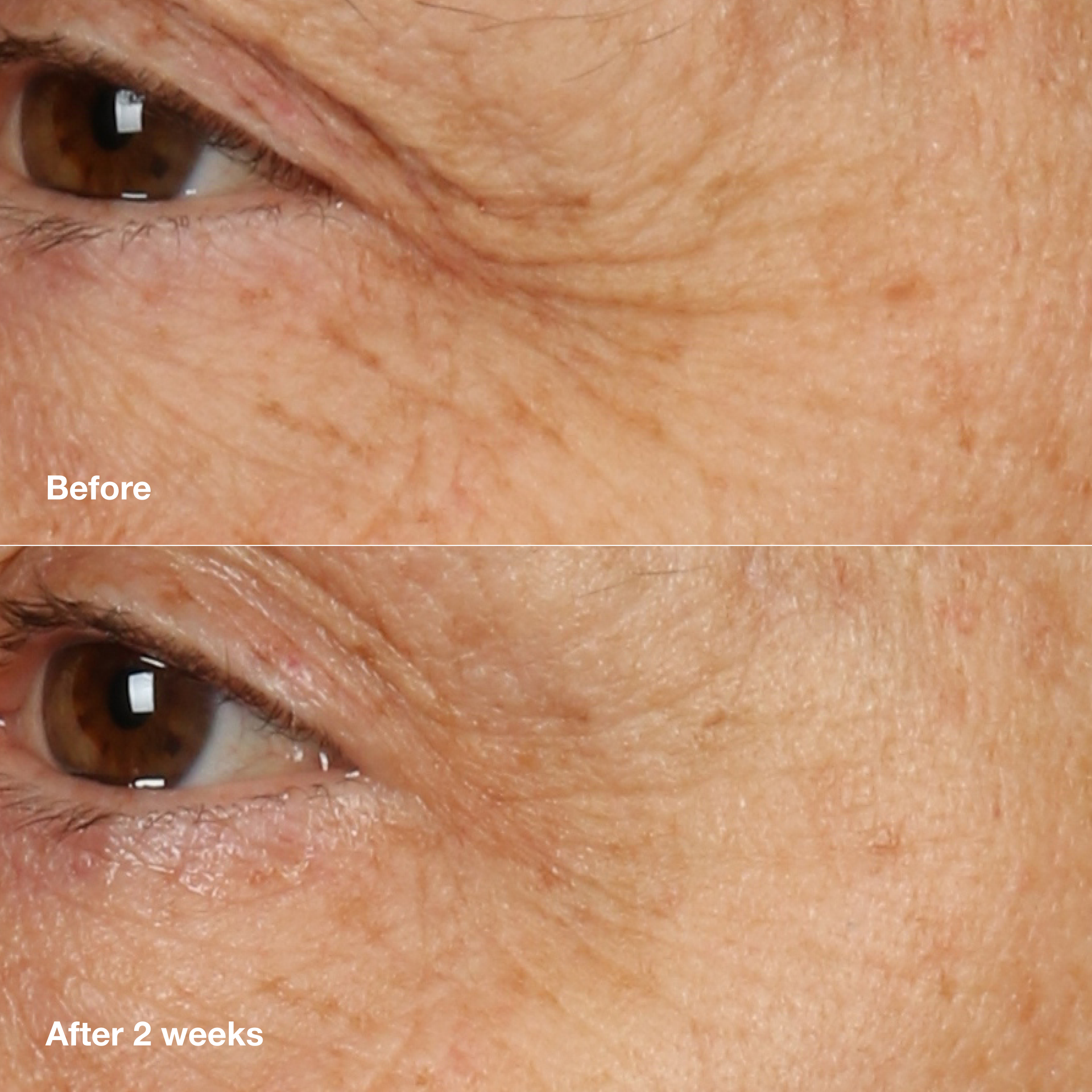 Clinique Smart Clinical Repair Overnight Cream & Mask