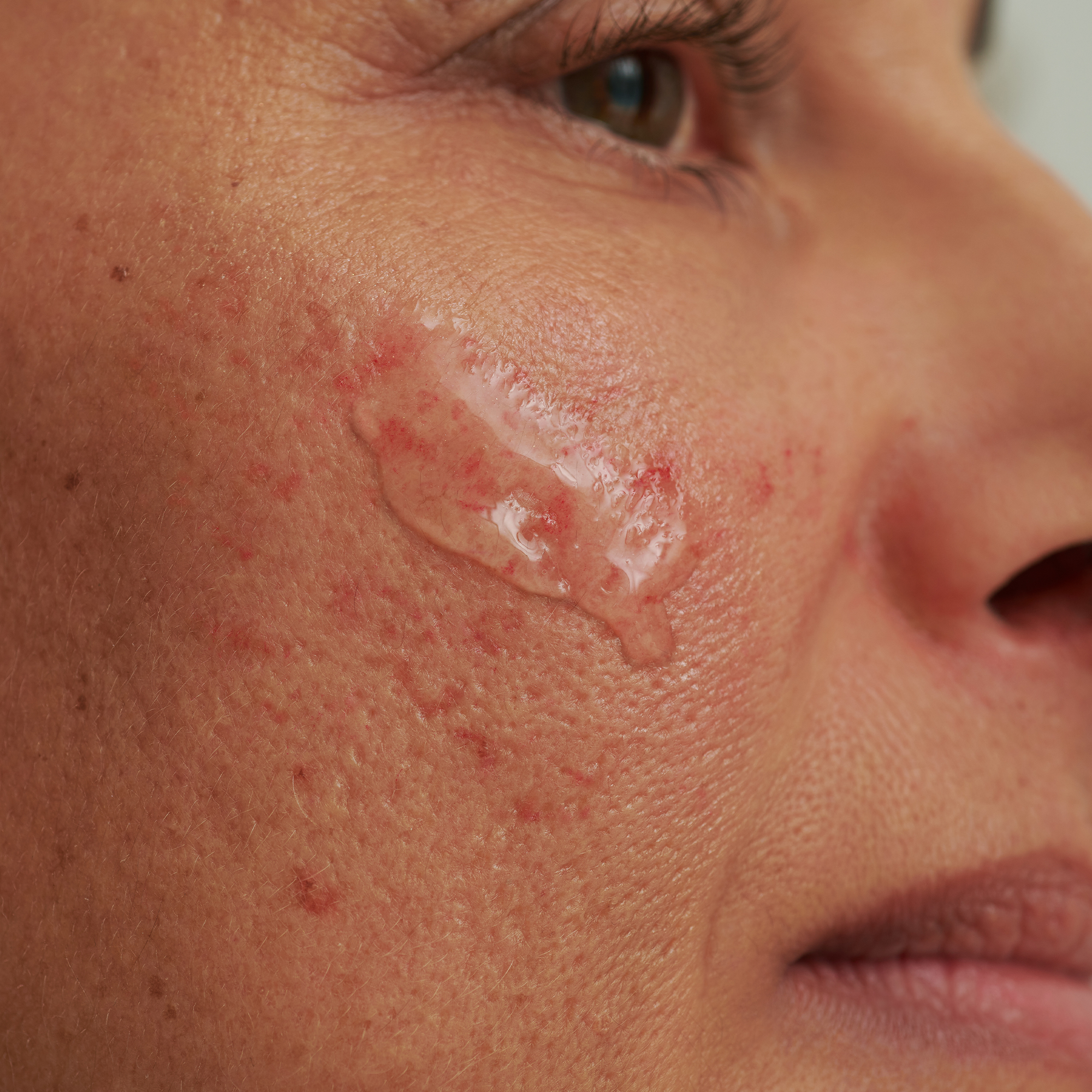 SENSACEA REINIGUNGSGEL