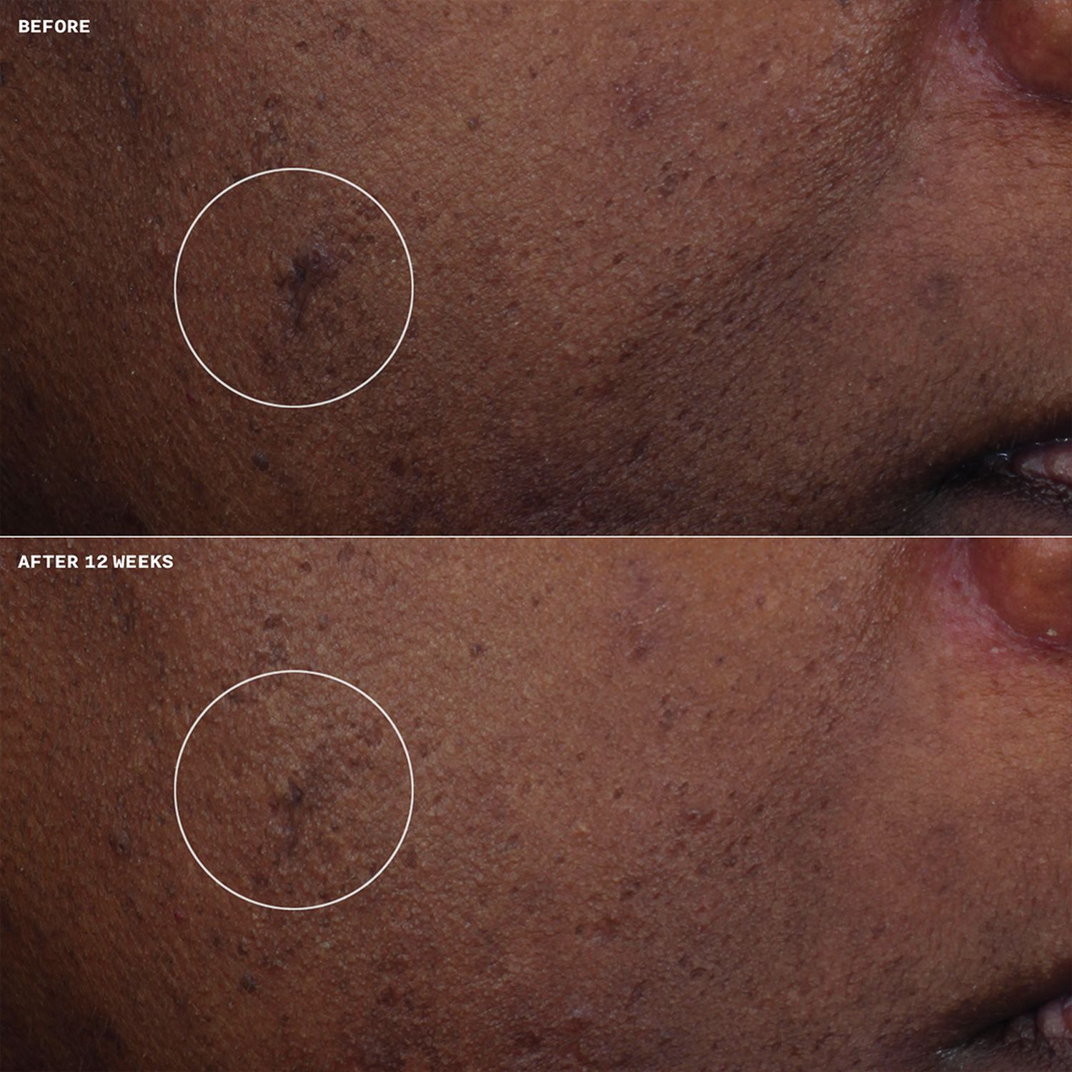 Even Better Clinical Brightening Moisturizer