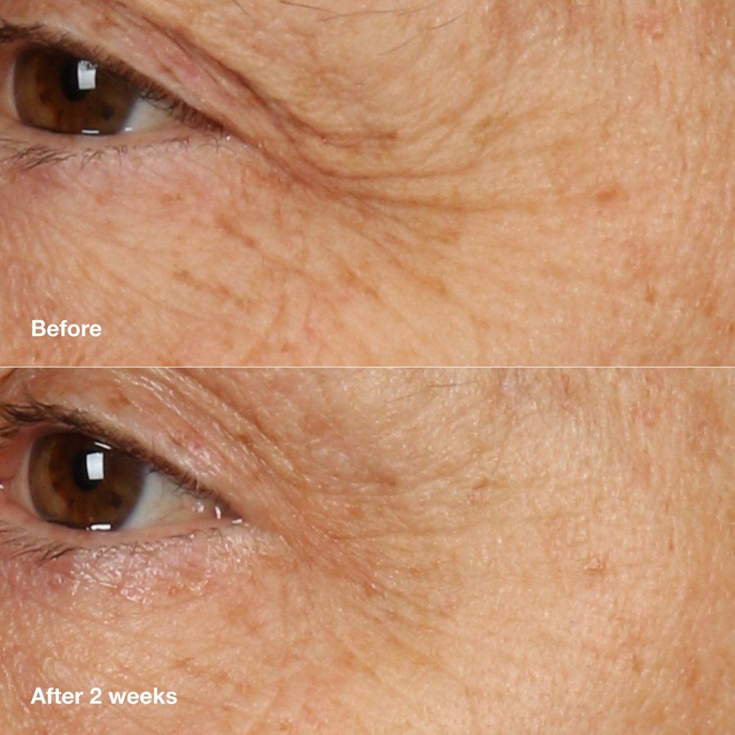 Clinique Smart Clinical Repair Overnight Cream & Mask